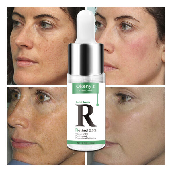 Retinol and Vitamin C Facial Serum